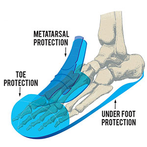 Rhyolite Metatarsal Black S3